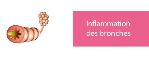 inflammation des bronches